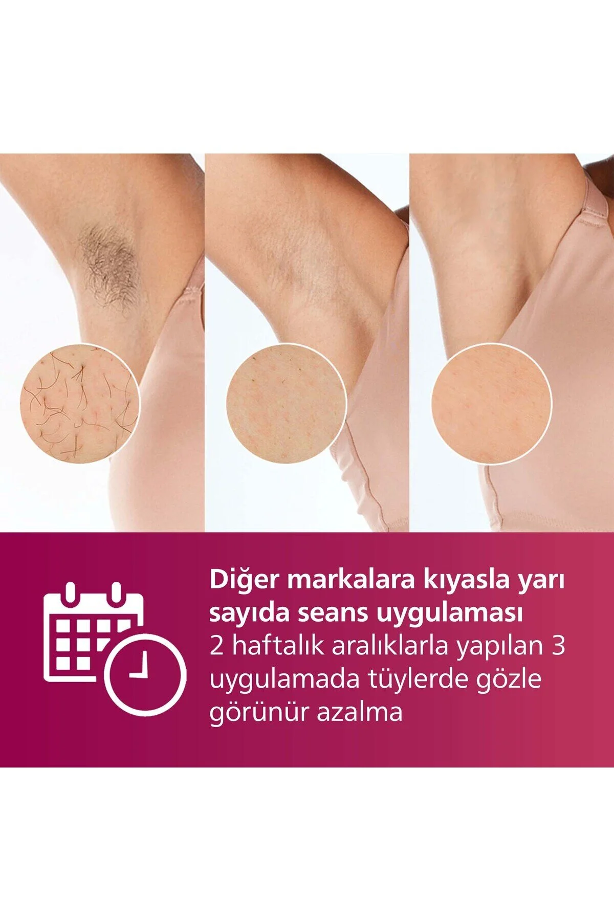 Philips Lumea 7000 Serisi BRI924/00 IPL Tüy Alma,Yüz Temizleme Cihazı, Vücut ve Yüz, 2 Başlık, Çanta