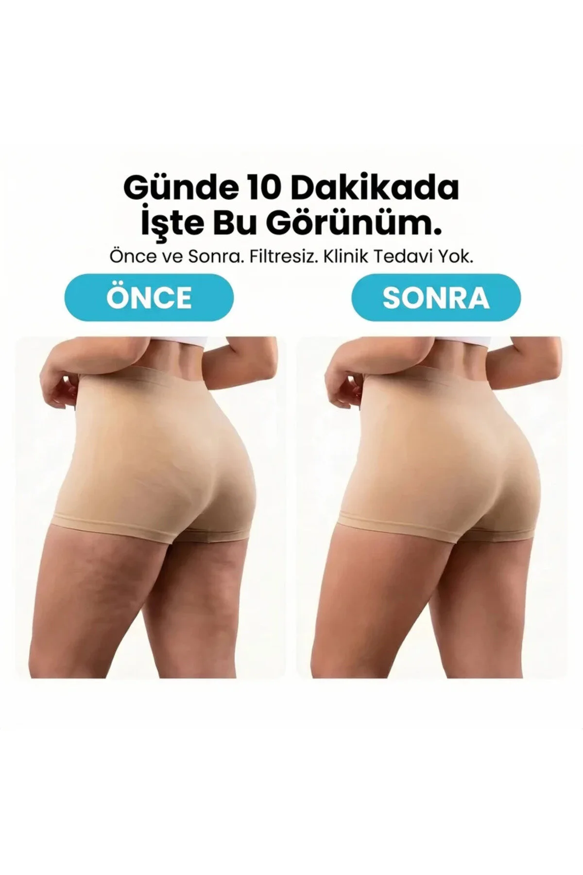 ZAEN Selülit Roller Şarjlı 360° Döner Masaj Aleti, 3 Hız Kademeli,